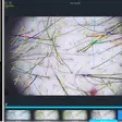 Căderea părului: diagnostic corect și tratament personalizat la dermatolog by Centrul Medical Dr. Mihălceanu