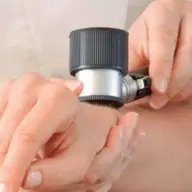 Ce este Dermatoscopia