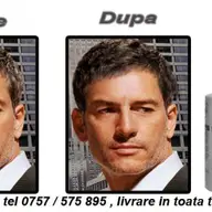Tratament repigmentare par
