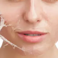 Stie careva un medic estetician un la care as putea apela pentru un peeling chimic?