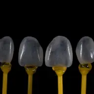 Dentcof - Fatete prepless