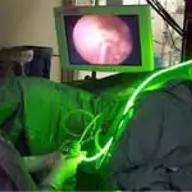 Operatia cu Laser verde pentru prostata
