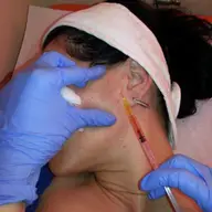 Terapia PRP - Platelet Rich Plasma