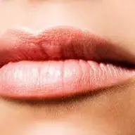 Marirea buzelor cu acid hialuronic in Timisoara