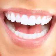 Coroanele dentare si utilitatea acestora