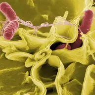 De ce PROBIOTICE si hrana cu aport probiotic?