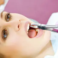 Extractii dentare in Timisoara