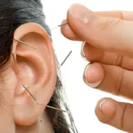 Auriculoterapia - acupunctura urechii