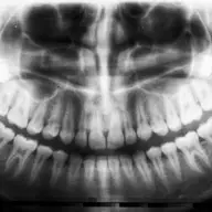 Stiai ca mersul la cabinetul stomatologic poate preveni dementa?
