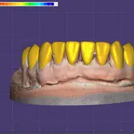 Laborator Tehnica Dentara Metaldent