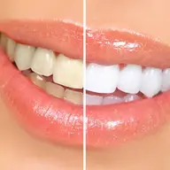Cum obtii dantura perfecta? Pasi simpli de urmat pentru rezultate remarcabile