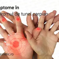 Cum se pune diagnosticul in sindromul de tunel carpian