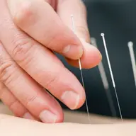 Cauti preturi tratamente acupunctura cat mai bune? Apeleaza la acupuncturabucuresti.ro