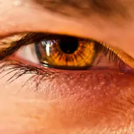 Blefaroplastia - moft sau necesitate