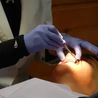 Tipuri de implanturi dentare: cum îl alegi pe cel potrivit?
