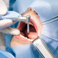 3 tipuri de implanturi dentare și avantajele lor