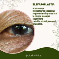 Operația de blefaroplastie aduce tinerețea pe chipul dumneavoastră