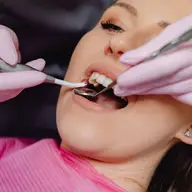 Tipuri de implant dentar Megagen si beneficiile pe care acestea ti le ofera