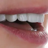 Cel mai bun material pentru coroanele dentare