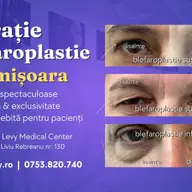 Vrei să faci operația de Blefaroplastie în Timișoara? Îți recomandăm Clinica Dr. Levy Medical Center