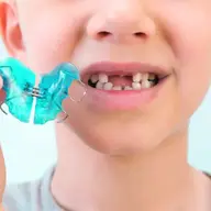 Aparatele dentare mobile pentru copii: o metodă preventivă de succes