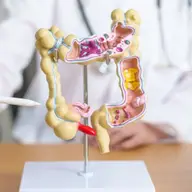 Ghid complet pentru regimul alimentar în diverticulită