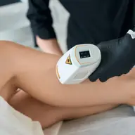 Când este cea mai bună perioadă pentru procedura de epilare definitivă?