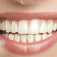 Igiena dentară, fundamentul unui zâmbet sănătos