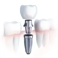 Când experiența face diferența: implantologie dentară la Centrul Medical Dr. Mihălceanu din Timișoara