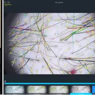 Căderea părului: diagnostic corect și tratament personalizat la dermatolog by Centrul Medical Dr. Mihălceanu