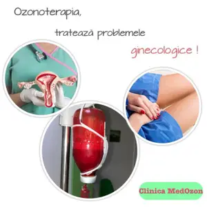 Ozonoterapia in tratarea afectiunile ginecologice
