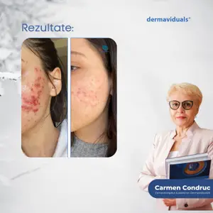 Este Vitamina B noul C?