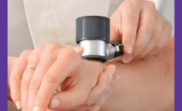 Ce este Dermatoscopia