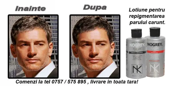 Tratament repigmentare par