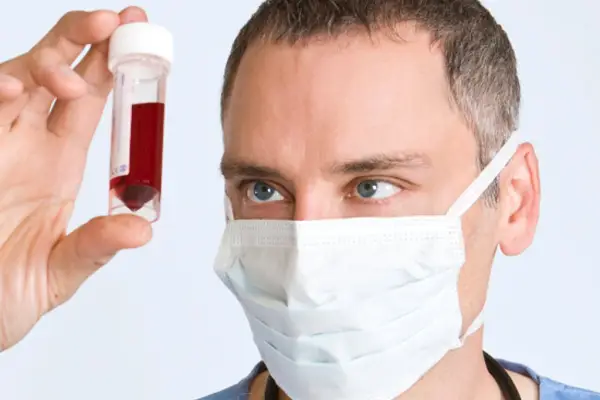 Analize gratuite cu ocazia Saptamanii europene a testarii HIV