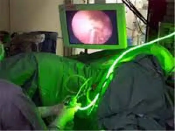 Operatia cu Laser verde pentru prostata