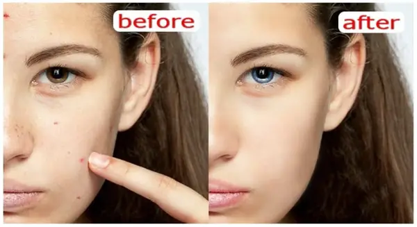 Curs: Editare Imagini În Photoshop