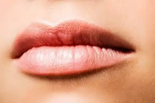 Marirea buzelor cu acid hialuronic in Timisoara