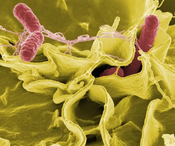 De ce PROBIOTICE si hrana cu aport probiotic?