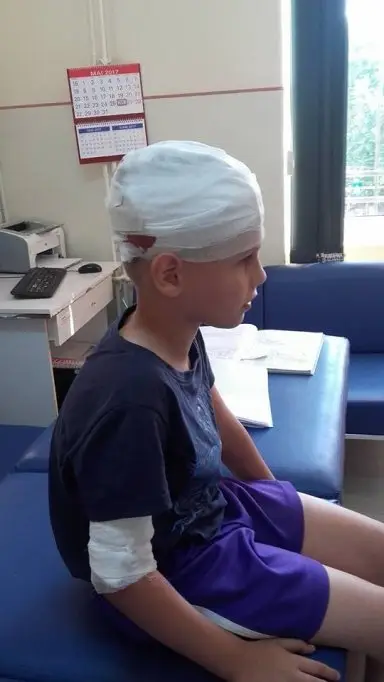 Copil atacat de caine, din neglijenta stapanilor, in Satul Albina