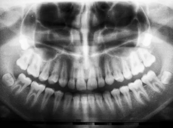 Stiai ca mersul la cabinetul stomatologic poate preveni dementa?