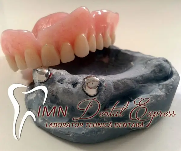 IMN Dental Express