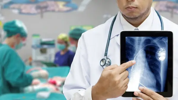 Proceduri minim invazive pentru implantarea unui stimulator cardiac