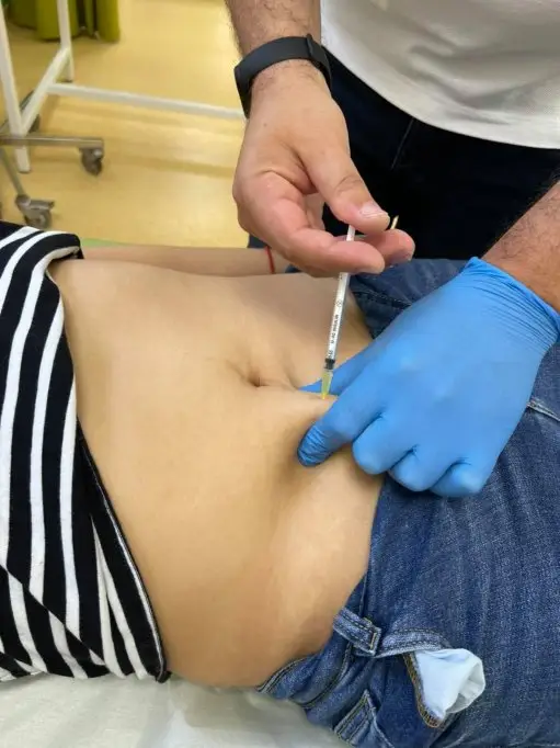 Eliminare grasime prin Lipoliza in Timisoara