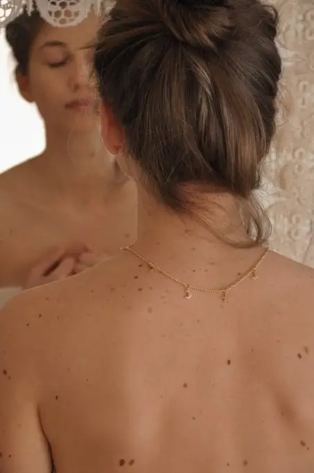 Tot ce trebuie sa stii despre alunite si vizita la dermatolog