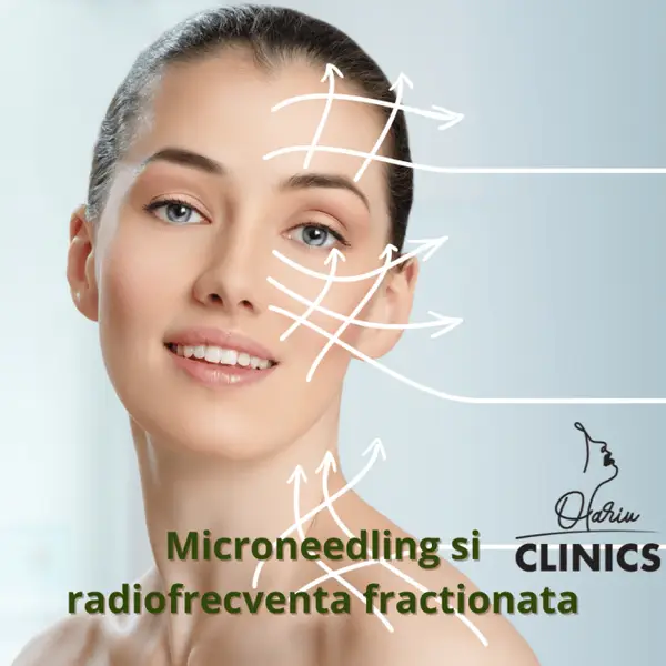 Reîntinerire cu radiofrecvență fracționată