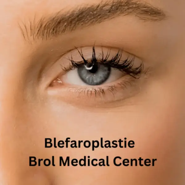 Blefaroplastie in Timisoara