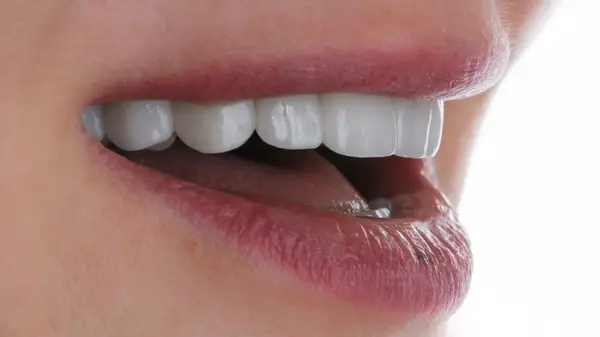 Cel mai bun material pentru coroanele dentare