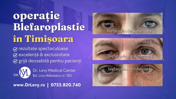 Vrei să faci operația de Blefaroplastie în Timișoara? Îți recomandăm Clinica Dr. Levy Medical Center