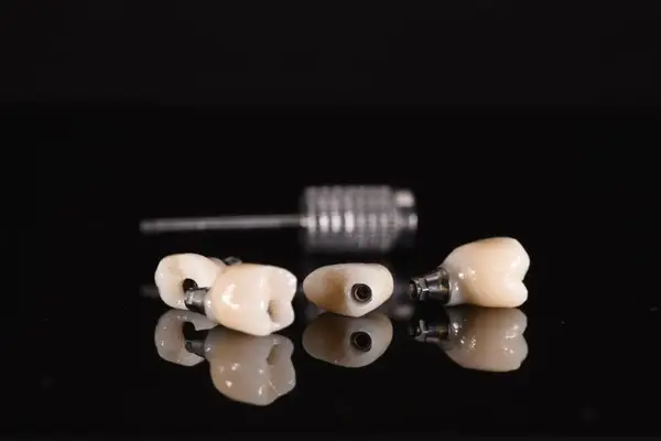 Tot ce trebuie să stiți despre implantul dentar la Eiffel Praxis